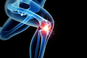 joint replacement surgery