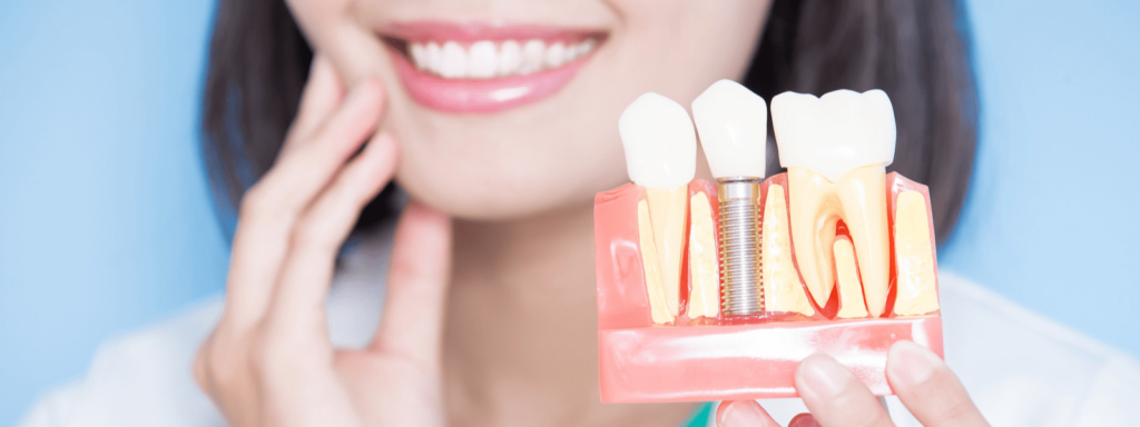 Bridges & Crowns Dental Clinic in Whitefield