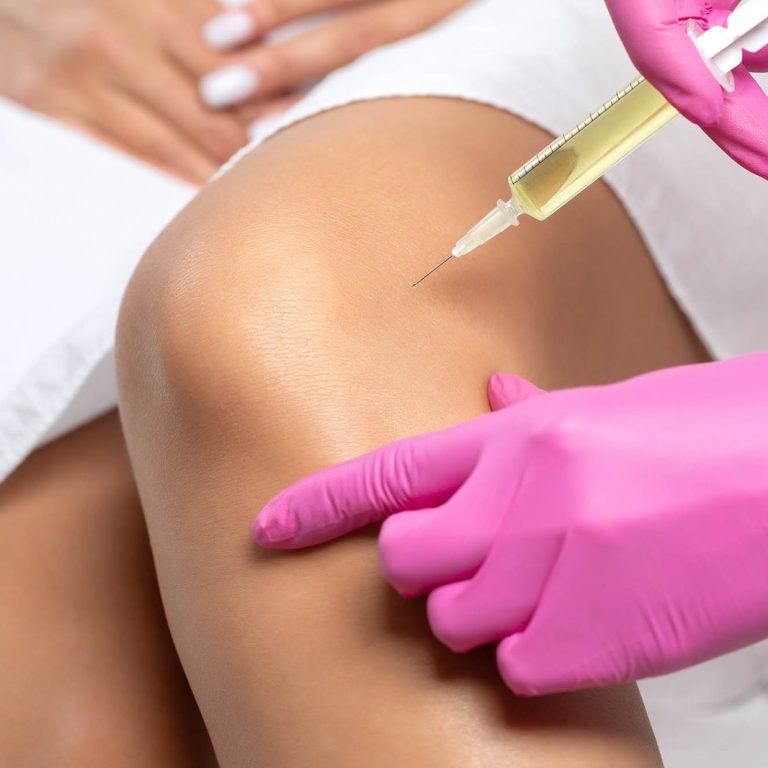 Doctor doing stem cell therapy on a patient's knee after the injury. Treating knee pain with platelet-rich plasma injection. Treatment of arthritis and osteoarthritis.Medical and cosmetology concept.