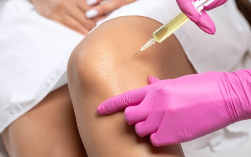 Doctor doing stem cell therapy on a patient's knee after the injury. Treating knee pain with platelet-rich plasma injection. Treatment of arthritis and osteoarthritis.Medical and cosmetology concept.