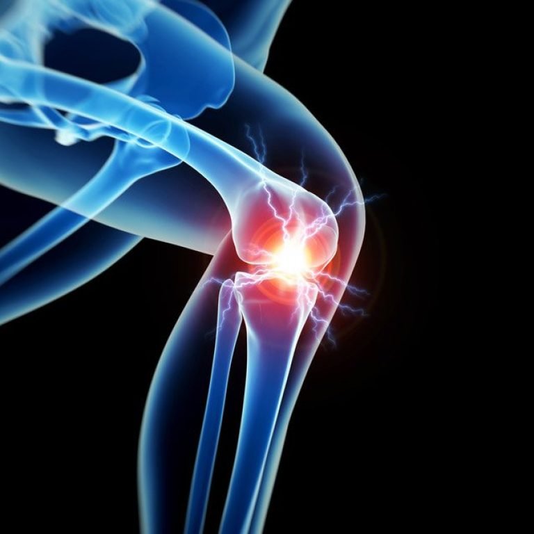 joint replacement surgery